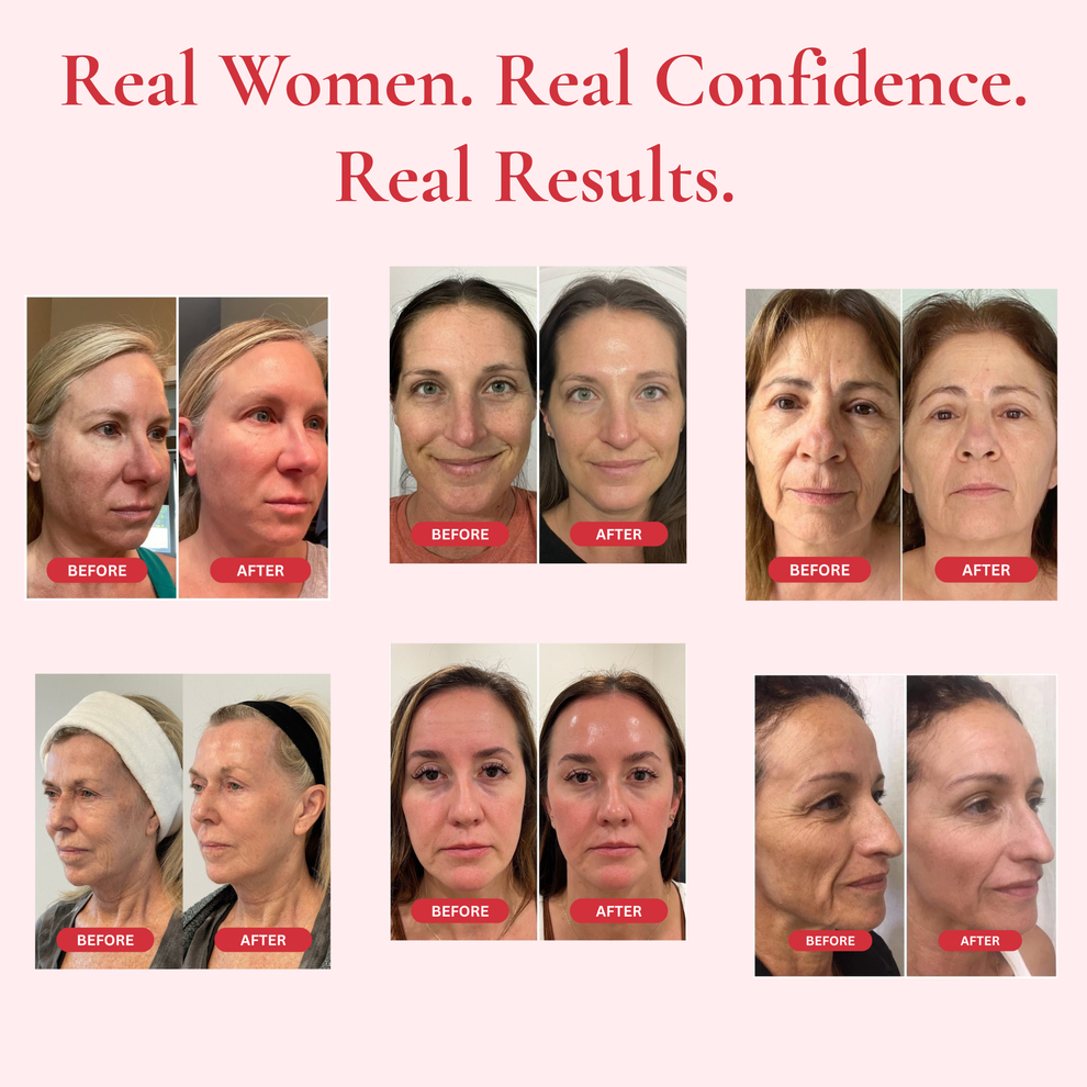 Vashara™ Madeca Cream Time Reverse